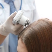 female alopecia hair transplants scalp st louis missouri